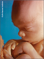 20 week fetus in the womb