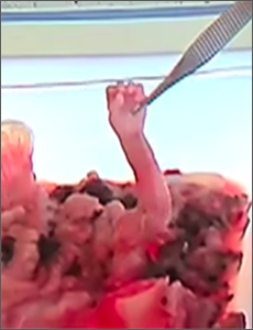 Daleiden picks up the dismembered hand of an aborted baby