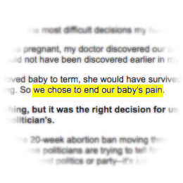 We chose to end our baby's pain.