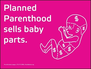 Planned Parenthood sells baby parts